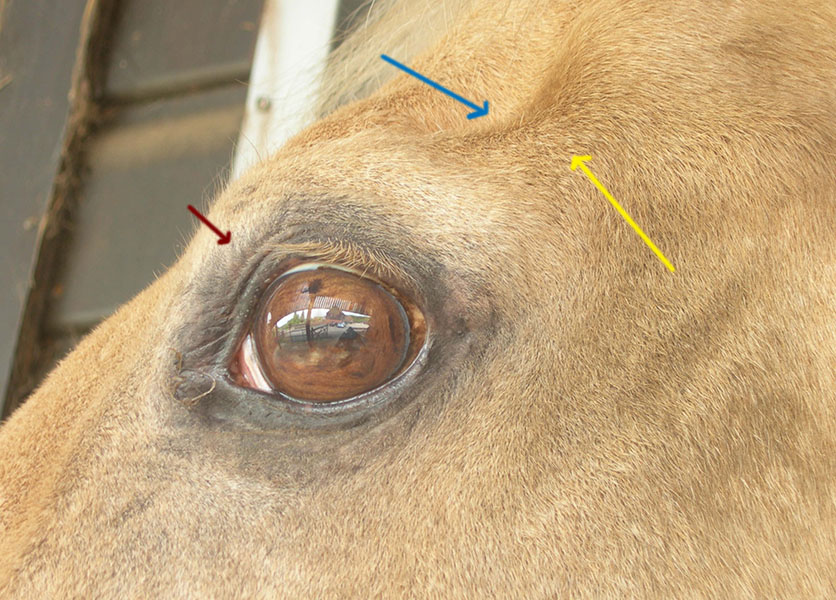 William_eye_side_view_showing_eyebrow_temporal_fossa_and_zygomatic_arch ...